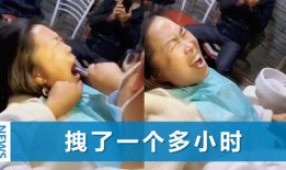拔牙视频全过程,拔牙手术的惊心动魄瞬间